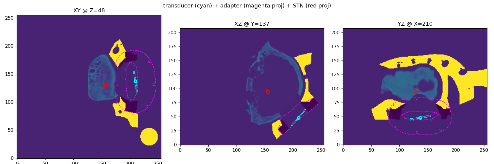 Sound-speed maps in three planes showing the transducer inside the device adapter aimed at the target